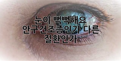 눈이 뻑뻑해요? 안구건조증인가, 다른 질환인가? 🤔