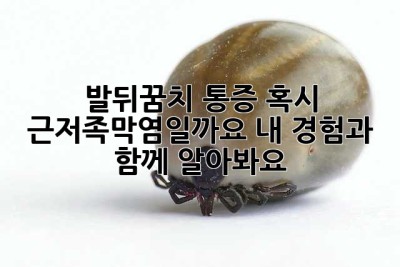 발뒤꿈치 통증? 혹시 근저족막염일까요? 내 경험과 함께 알아봐요!